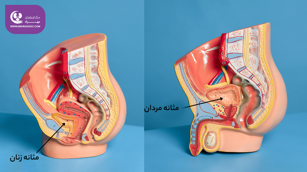 علائم سرطان مثانه | دکتر مهری مهراد، متخصص اورولوژی