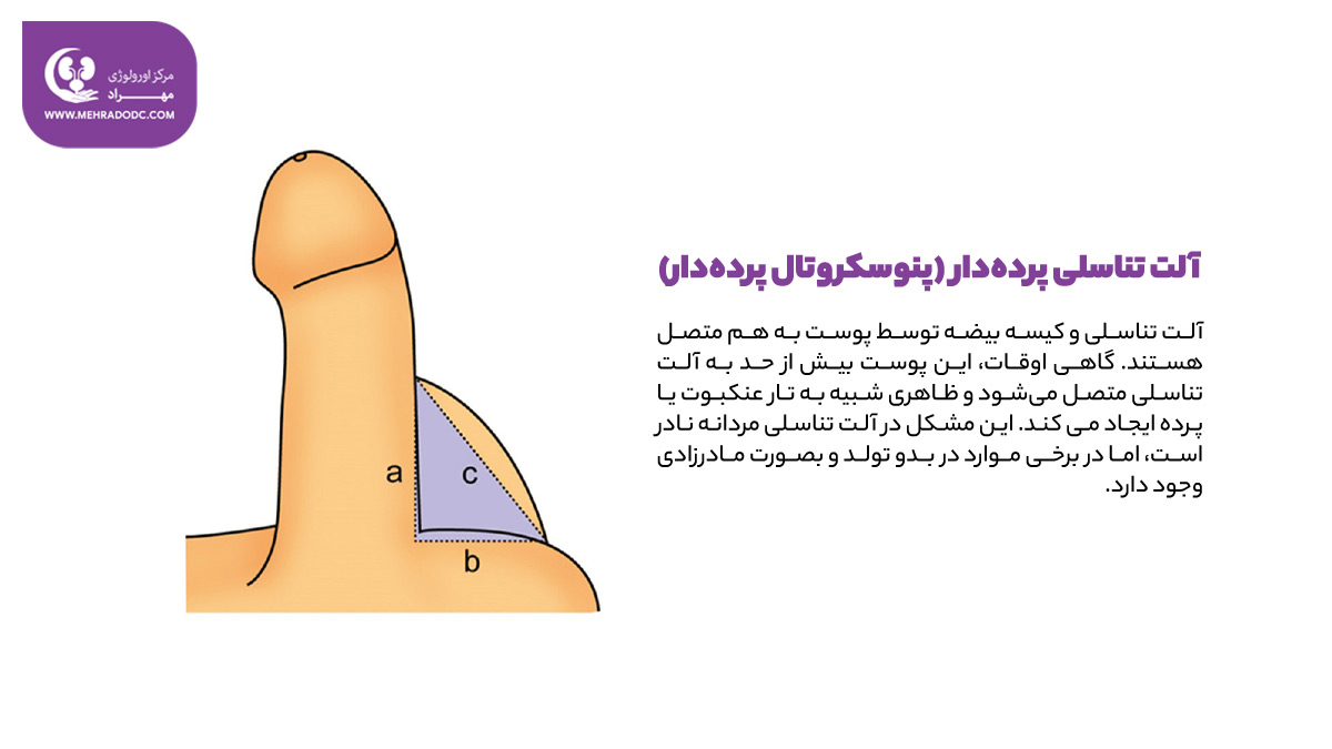 آلت تناسلی پردهدار چیست؟ | دکتر مهری مهراد، متخصص اورولوژی