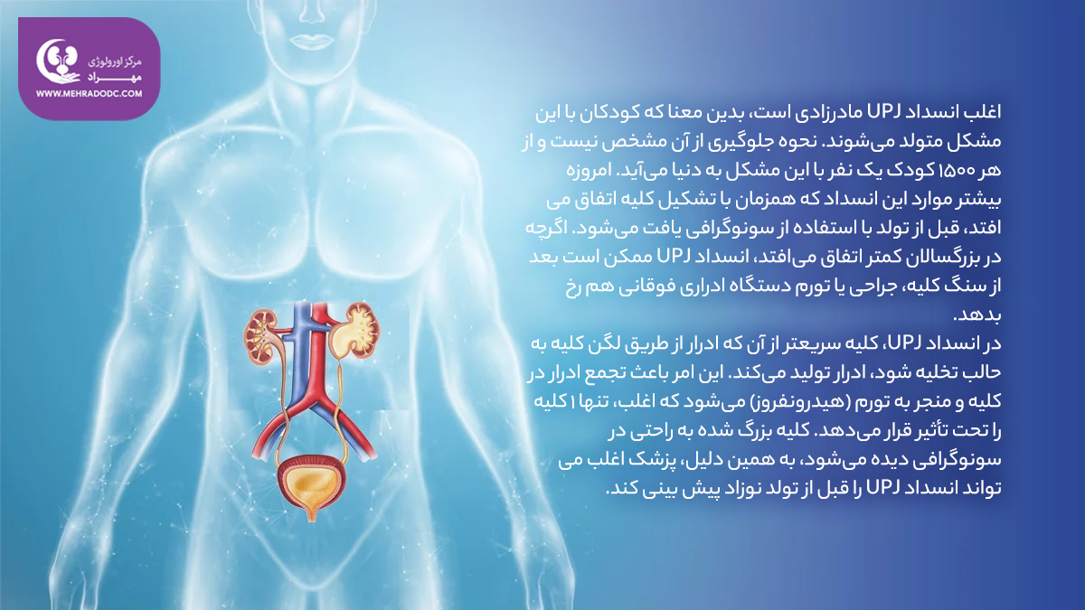علل انسداد حالب به لگنچه UPJ | دکتر مهری مهراد - متخصص اورولوژی