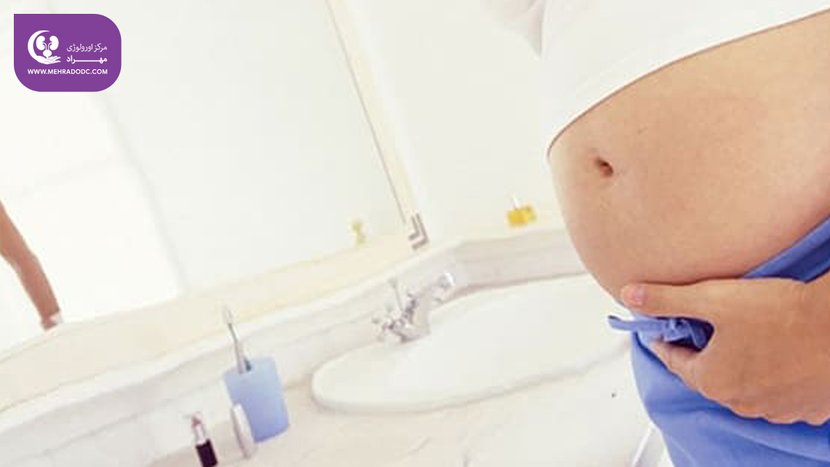 بی‌اختیاری ادرار در دوره بارداری 
