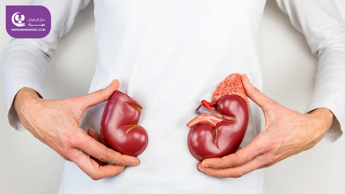 علل سرطان کلیه | دکتر مهری مهراد، متخصص اورولوژی