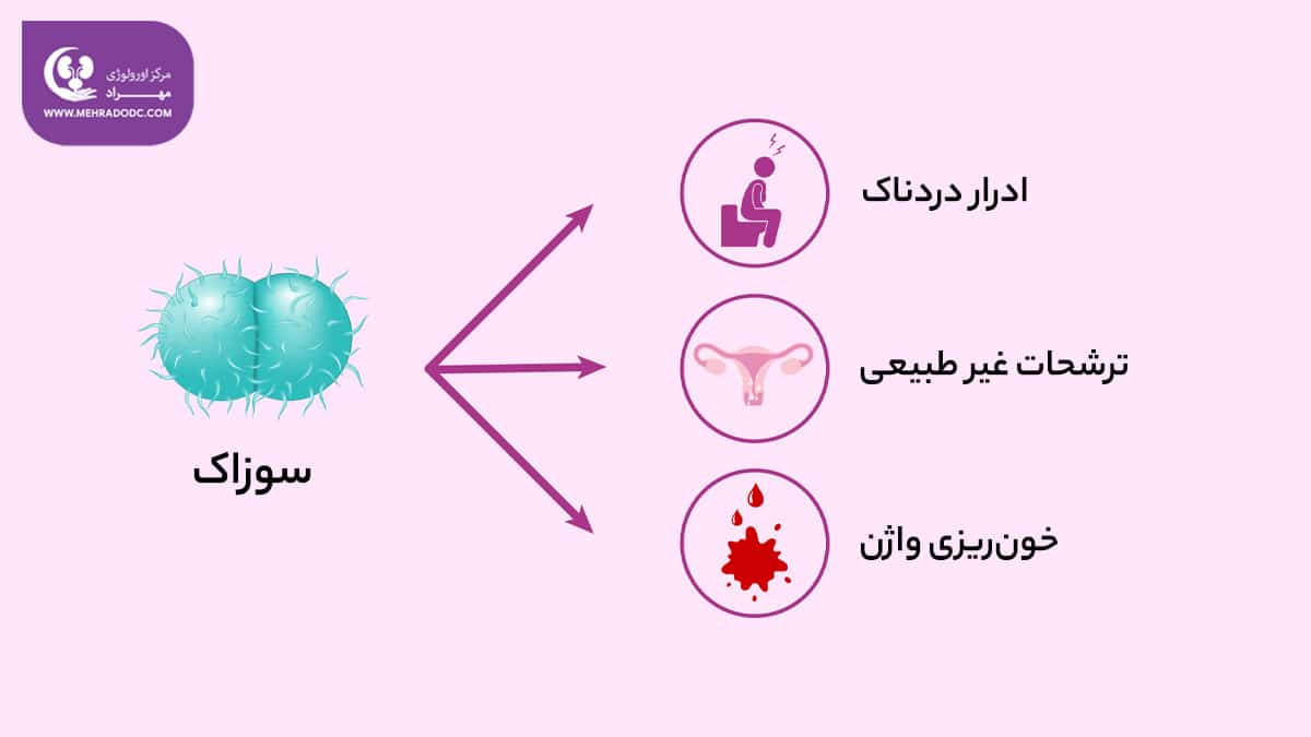 سایر علائم سوزاک در بانوان | دکتر مهری مهراد - متخصص اورولوژی در تهران