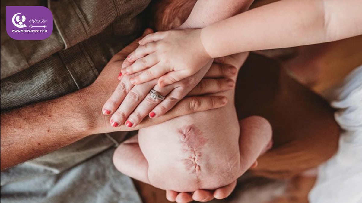 مهره شکاف یا اسپینا بیفیدا