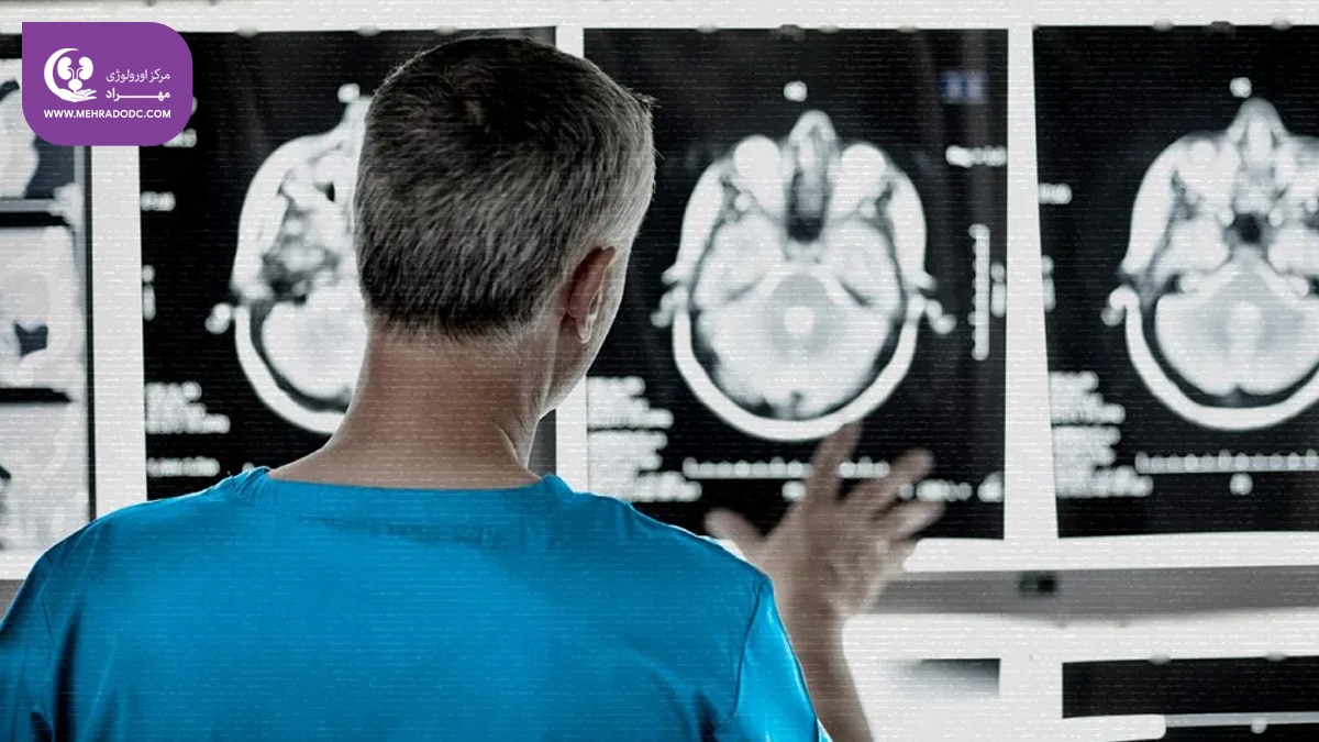 مثانه نوروژنیک | کلینیک تخصصی اورولوژی مهراد