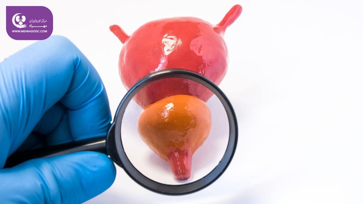 علائم پروستاتیت | دکتر مهری مهراد