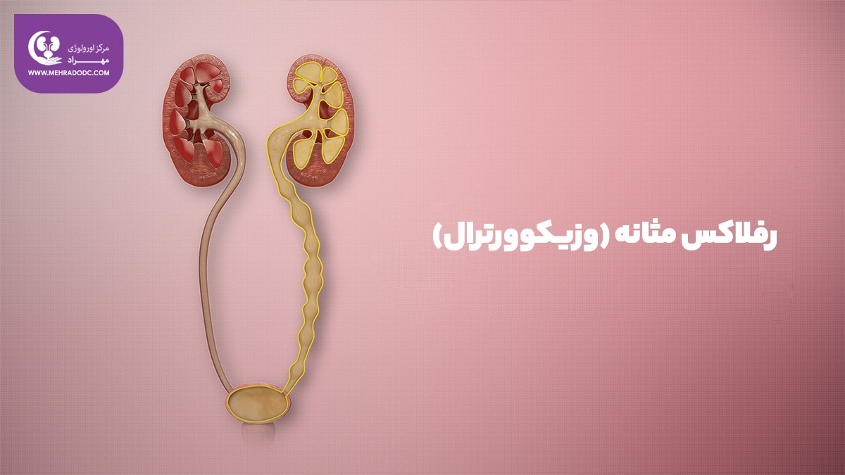 ریفلاکس وزیکوورترال | دکتر مهری مهراد