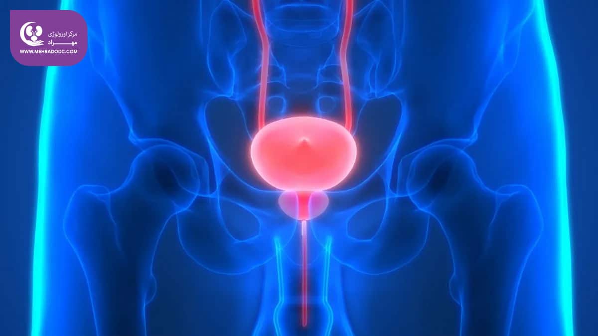 همه چیز درباره مثانه | کلینیک اورولوژی مهراد