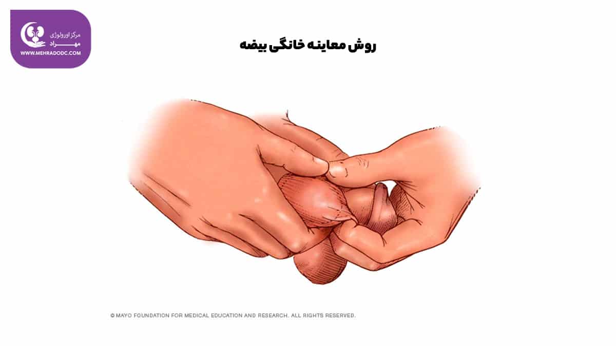 معاینه بیضه | دکتر مهری مهراد، متخصص اورولوژی در تهران