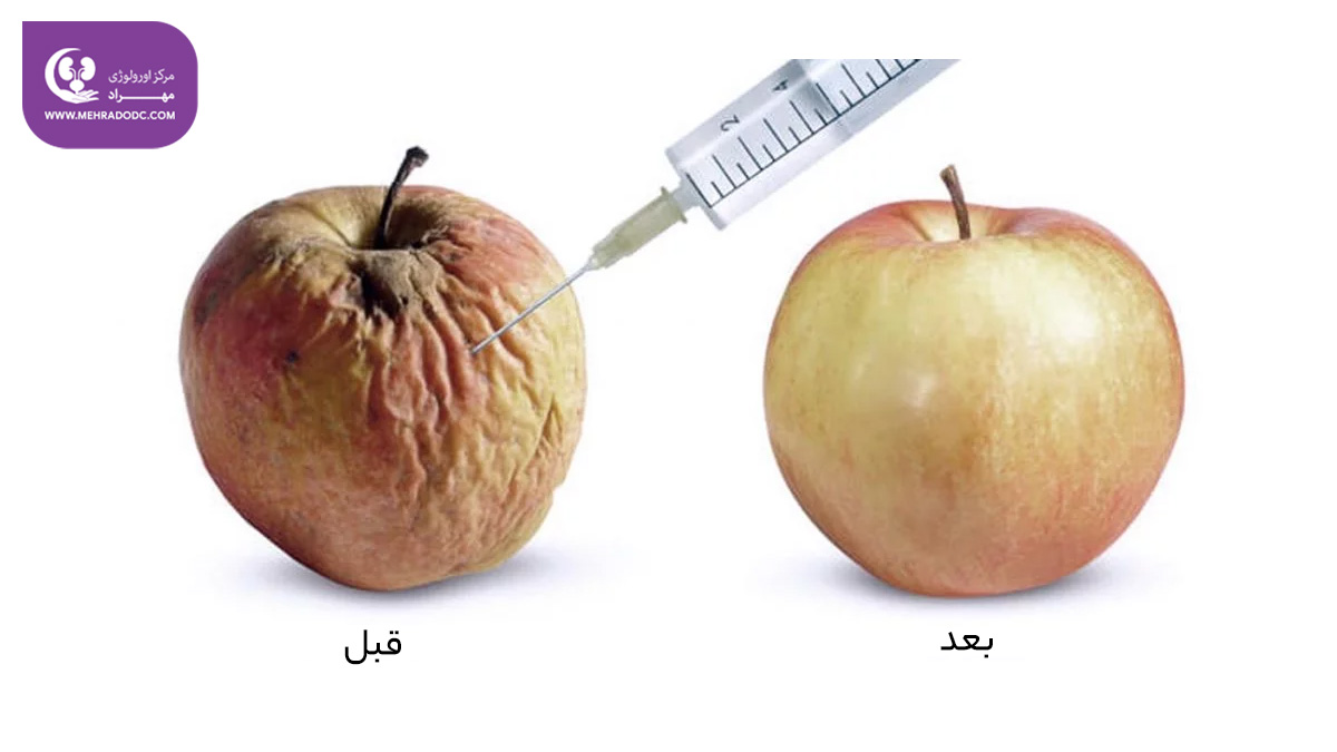 اسکروتاکس در تهران | کلینیک اورولوژی مهراد