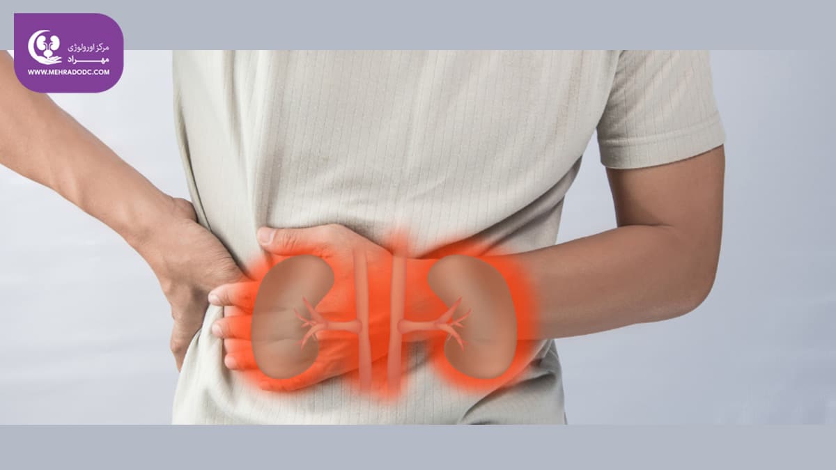 علائم سرطان کلیه | دکتر مهری مهراد، جراح و متخصص کلیه و مجاری ادرار