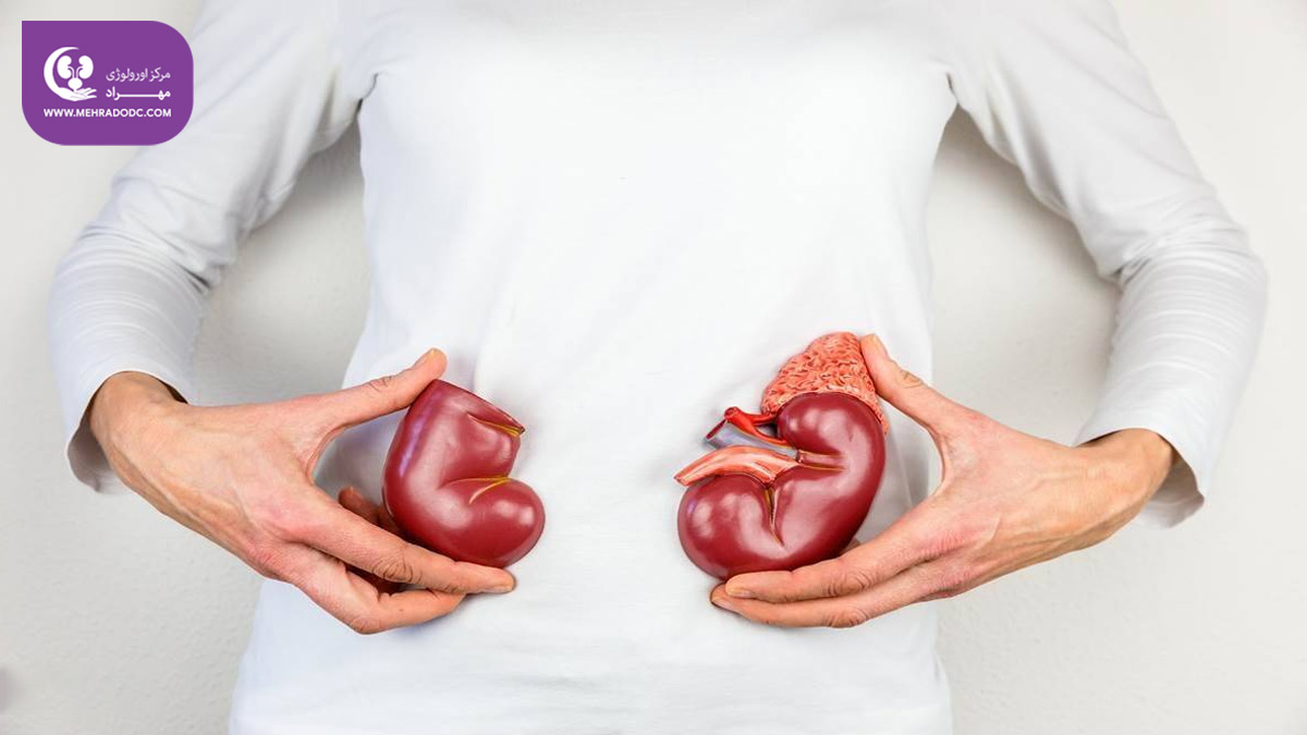 سلامت کلیه | دکتر مهری مهراد، اورولوژیست