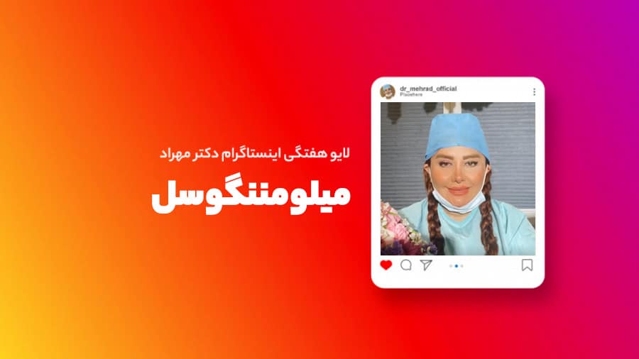 لایو هفتگی | میلومننگوسل