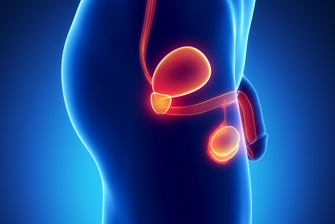 Urethral Strictures
