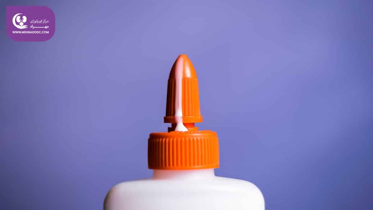 Diagnosis and treatment of ejaculation problems in men