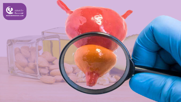 ۶ درمان طبیعی برای بزرگی پروستات (BPH)