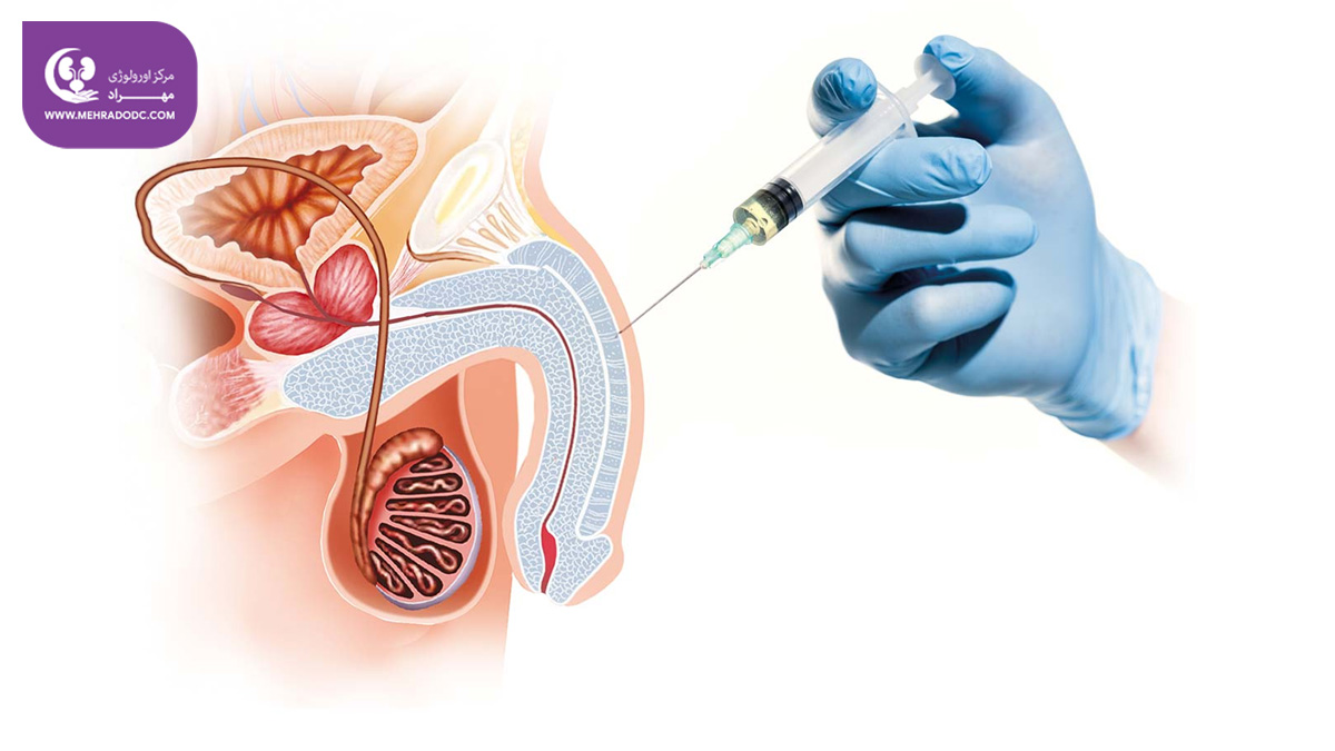 PRP, P-Shot و آلت تناسلی شما