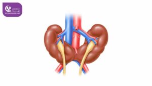 کلیه نعل اسبی یا فیوژن کلیه چیست؟